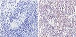 CD25 Antibody in Immunohistochemistry (Paraffin) (IHC (P))