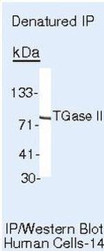 TGM2 Antibody in Immunoprecipitation (IP)