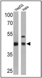 RPSA Antibody in Western Blot (WB)