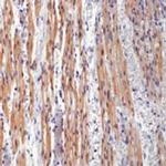 Cardiac Troponin T Antibody in Immunohistochemistry (Paraffin) (IHC (P))