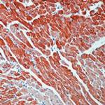 Cardiac Troponin T Antibody in Immunohistochemistry (Paraffin) (IHC (P))