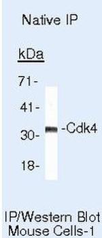 CDK4 Antibody in Immunoprecipitation (IP)