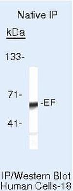 Estrogen Receptor alpha Antibody in Immunoprecipitation (IP)