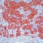 Chromogranin A Antibody in Immunohistochemistry (Paraffin) (IHC (P))