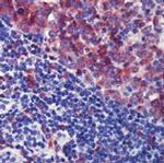 CD35 Antibody in Immunohistochemistry (Paraffin) (IHC (P))