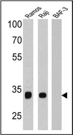 CD20 Antibody in Western Blot (WB)