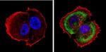 Cytokeratin Pan Type I Antibody in Immunocytochemistry (ICC/IF)