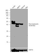 Cytokeratin Pan Type I/II Antibody