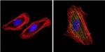 Cytokeratin Pan Type I/II Antibody in Immunocytochemistry (ICC/IF)