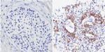 Cytokeratin Pan Type I/II Antibody in Immunohistochemistry (Paraffin) (IHC (P))