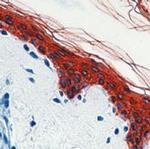 Cytokeratin Pan Type I/II Antibody in Immunohistochemistry (Paraffin) (IHC (P))