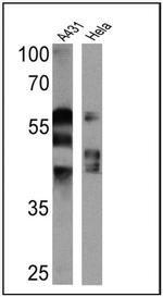 Cytokeratin Pan Type I/II Antibody in Western Blot (WB)