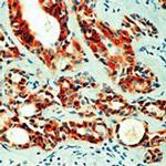 VEGF Antibody in Immunohistochemistry (Paraffin) (IHC (P))