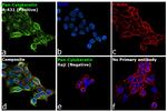 Cytokeratin Pan Antibody