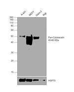 Cytokeratin Pan Antibody