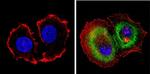 Cytokeratin Pan Antibody in Immunocytochemistry (ICC/IF)