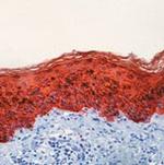 Cytokeratin Pan Antibody in Immunohistochemistry (Paraffin) (IHC (P))