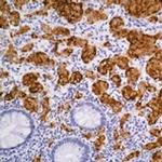 Chromogranin A Antibody in Immunohistochemistry (Paraffin) (IHC (P))