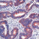 Paxillin Antibody in Immunohistochemistry (Paraffin) (IHC (P))