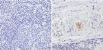 Thrombospondin 1 Antibody in Immunohistochemistry (Paraffin) (IHC (P))