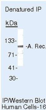 Androgen Receptor Antibody in Immunoprecipitation (IP)