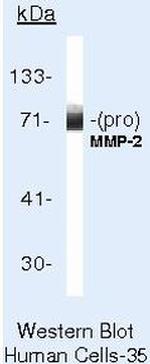 MMP2 Antibody in Western Blot (WB)