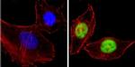 CBP Antibody in Immunocytochemistry (ICC/IF)