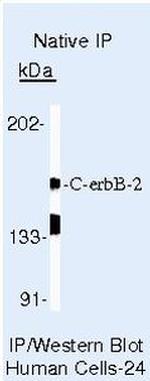 ErbB2 (HER-2) Antibody in Immunoprecipitation (IP)