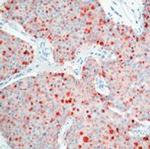 TIMP1 Antibody in Immunohistochemistry (Paraffin) (IHC (P))