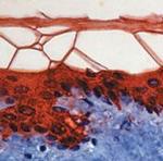 Cytokeratin 10 Antibody in Immunohistochemistry (Paraffin) (IHC (P))