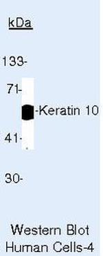 Cytokeratin 10 Antibody in Western Blot (WB)