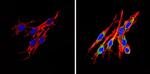 INSR beta Antibody in Immunocytochemistry (ICC/IF)