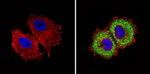 INSR beta Antibody in Immunocytochemistry (ICC/IF)