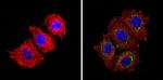 INSR Antibody in Immunocytochemistry (ICC/IF)