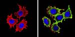 IGF1R alpha Antibody in Immunocytochemistry (ICC/IF)