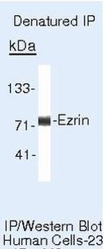 Ezrin Antibody in Immunoprecipitation (IP)