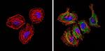 Bax Antibody in Immunocytochemistry (ICC/IF)