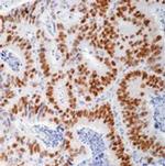 p53 Antibody in Immunohistochemistry (Paraffin) (IHC (P))