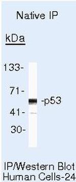 p53 Antibody in Immunoprecipitation (IP)