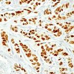 Estrogen Receptor alpha Antibody in Immunohistochemistry (Paraffin) (IHC (P))