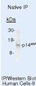 p14ARF Antibody in Immunoprecipitation (IP)