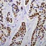 Estrogen Receptor alpha Antibody in Immunohistochemistry (Paraffin) (IHC (P))