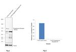 Progesterone Receptor Antibody in Western Blot (WB)