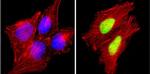 Cyclin D1 Antibody in Immunocytochemistry (ICC/IF)