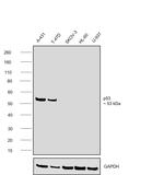 p53 Antibody in Western Blot (WB)