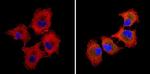 ALK Antibody in Immunocytochemistry (ICC/IF)