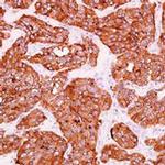 Synaptophysin Antibody in Immunohistochemistry (Paraffin) (IHC (P))