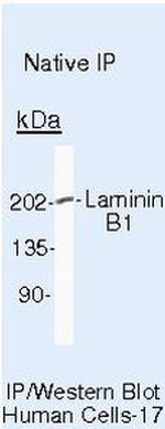 Laminin beta-1 Antibody in Immunoprecipitation (IP)