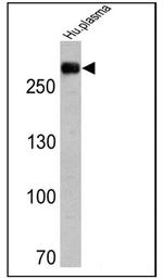 Fibronectin Antibody in Western Blot (WB)