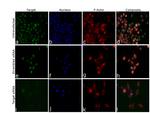 JMJD1B Antibody in Immunocytochemistry (ICC/IF)